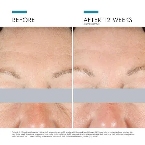 Skinceuticals AGE Interrupter Advanced